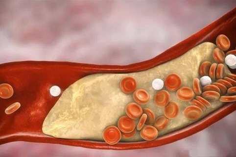 Peripheral vein disease